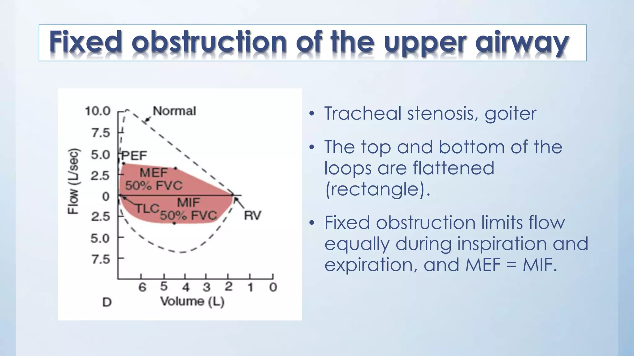 • Tracheal stenosis, goiter
• The top and bottom of the
loops are flattened
(rectangle).
• Fixed obstruction limits flow
equally during inspiration and
expiration, and MEF = MIF.
Fixed obstruction of the upper airway
 