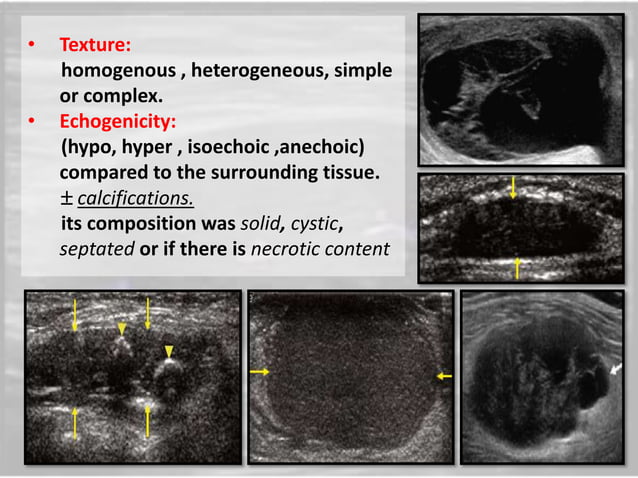 Role of ultrasound and color Doppler in evaluation of musculoskeletal ...