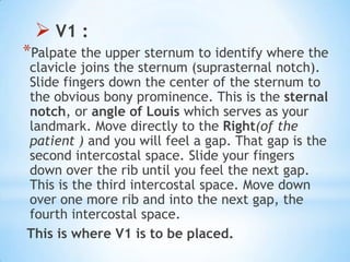  V1 :
*Palpate the upper sternum to identify where the
clavicle joins the sternum (suprasternal notch).
Slide fingers down the center of the sternum to
the obvious bony prominence. This is the sternal
notch, or angle of Louis which serves as your
landmark. Move directly to the Right(of the
patient ) and you will feel a gap. That gap is the
second intercostal space. Slide your fingers
down over the rib until you feel the next gap.
This is the third intercostal space. Move down
over one more rib and into the next gap, the
fourth intercostal space.
This is where V1 is to be placed.
 