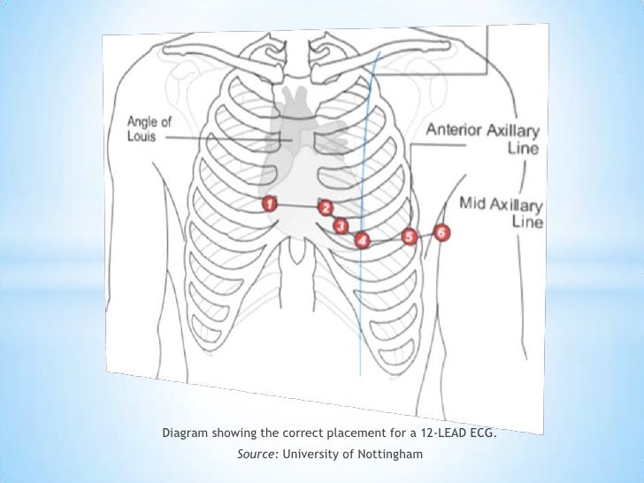 12 Lead Electrocardiogram