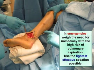 10-May-14 33
In emergencies,
weigh the need for
immediacy with the
high risk of
pulmonary
aspiration.
Use the lightest
effective sedation
possible.
 