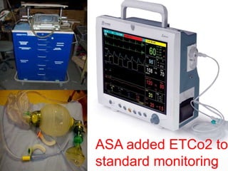 10-May-14 38
ASA added ETCo2 to
standard monitoring
 