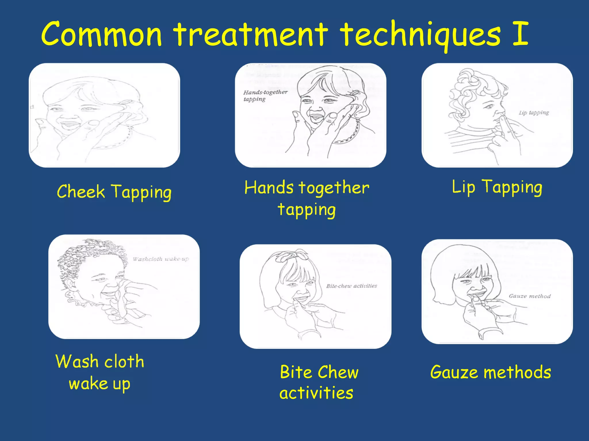 Common treatment techniques I  Bite Chew activities  Gauze methods 