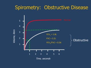 Spirometry: Obstructive Disease

                 5                                  Normal

                 4
Volume, liters




                 3
                                  FEV1 = 1.8L
                 2                FVC = 3.2L
                                                             Obstructive
                                  FEV1/FVC = 0.56
                 1



                     1   2   3    4      5      6

                         Time, seconds
 