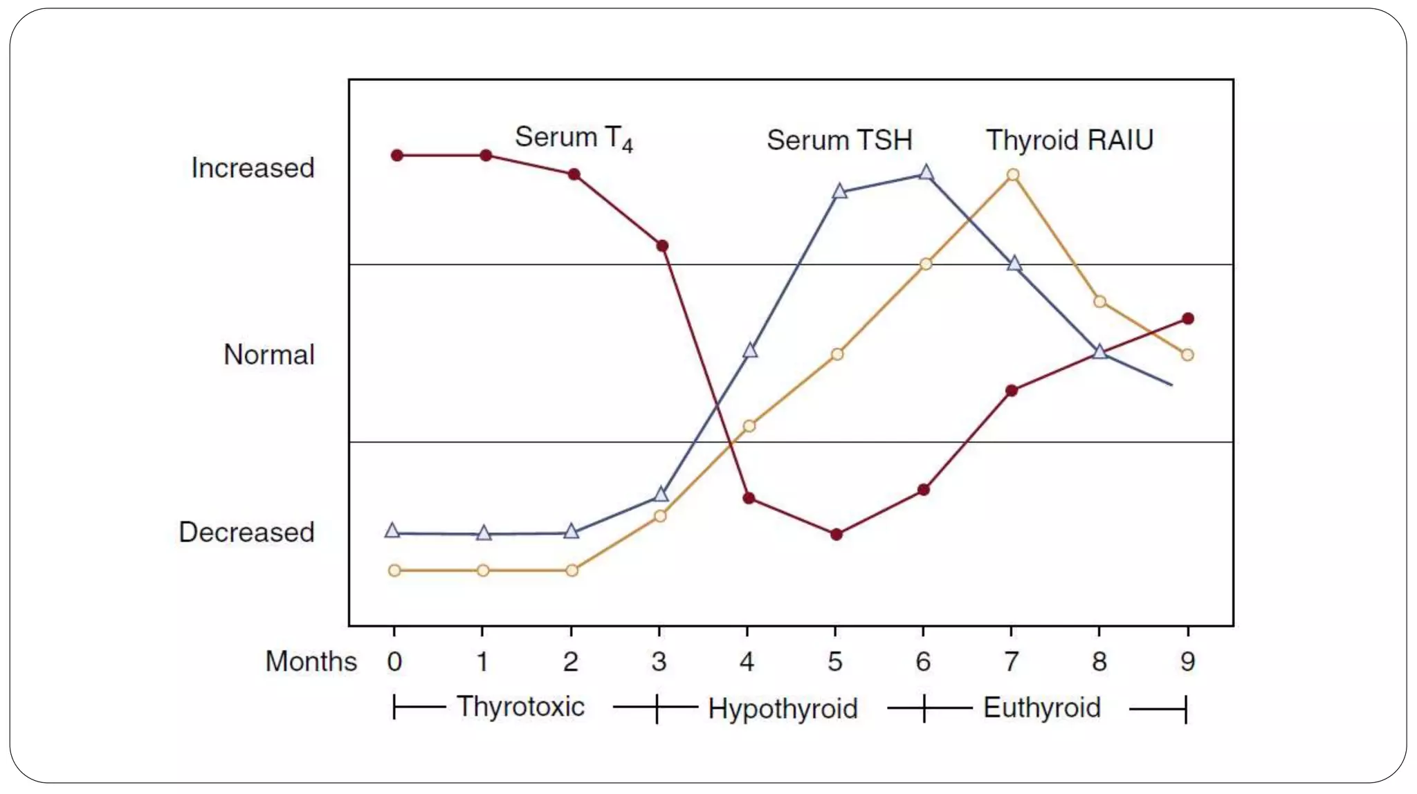 my presentation on grave disease differential diagnosis.pptx