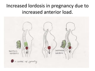 Increased lordosis in pregnancy due to
increased anterior load.

 