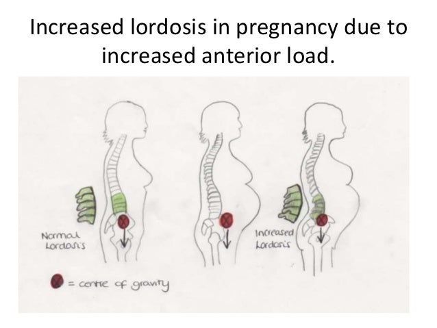 Anatomical changes in Pregnancy
