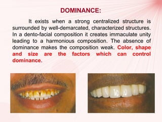 principles of smile designing dr.rinku | PPT
