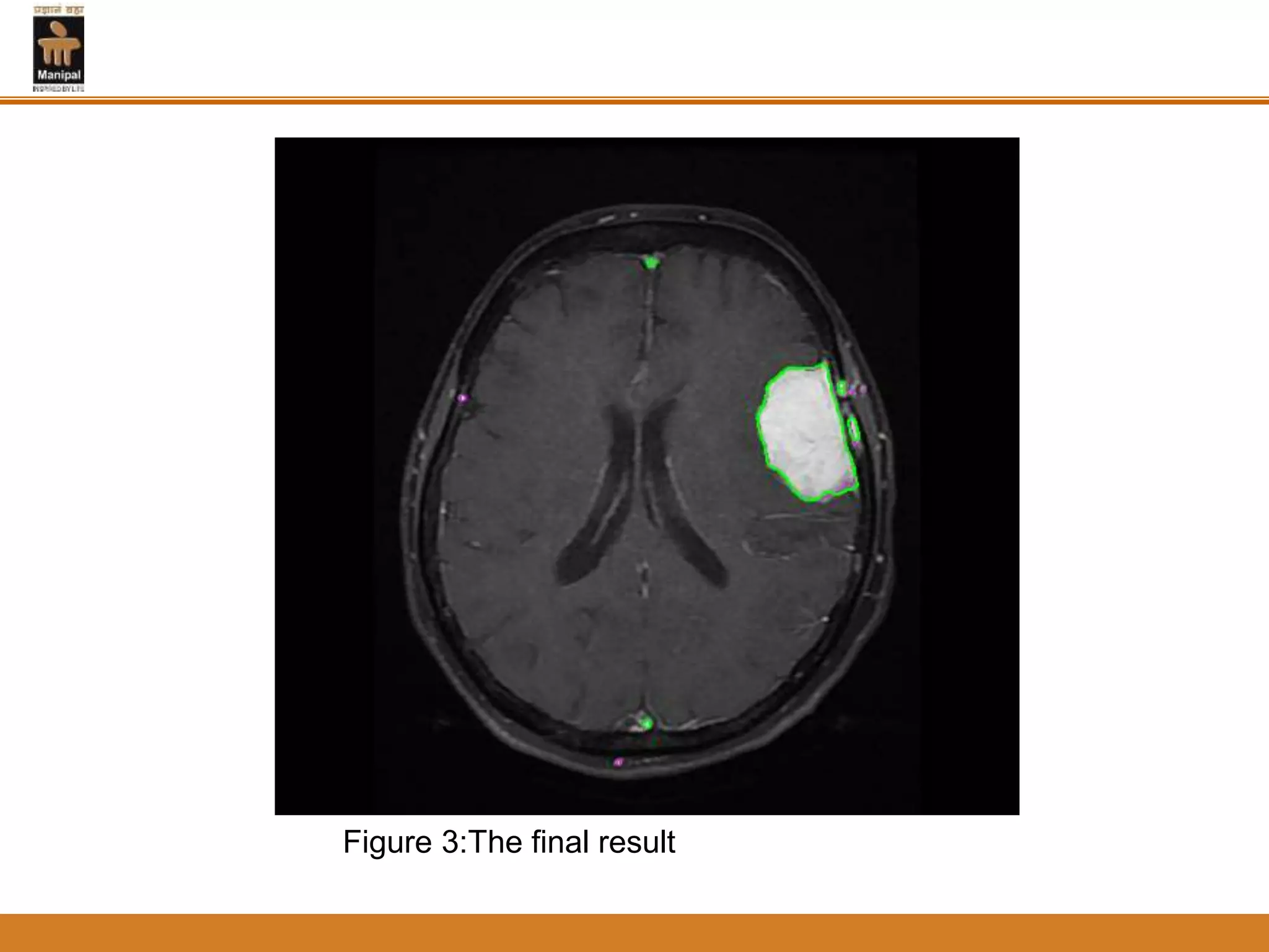 Figure 3:The final result
 