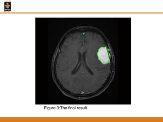 Figure 3:The final result
 