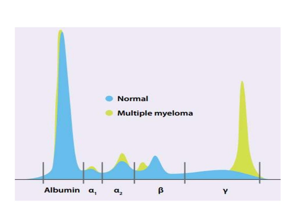 Essentials in Protein Electrophoresis