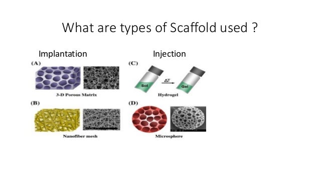 types of scaffolds in tissue engineering Drug release in Tissue engineering types of scaffolds in tissue engineering Drug release in Tissue engineering