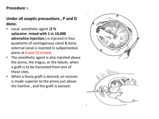 Procedure :-
Under all aseptic precautions , P and D
done.
• Local anesthetic agent (2 %
xylocaine mixed with 1 in 10,000
adrenaline injection.) is injected in four
quadrants of cartilagenous canal & bony
external canal is injected in subperiosteal
plane at 6 and 12 o’clock.
• The anesthetic agent is also injected above
the pinna, the tragus, or the lobule, when
a graft is to be harvested from one of
these sites.
• When a fascia graft is desired, an incision
is made superior to the pinna just above
the hairline , and the graft is excised.
 