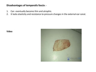 Disadvantages of temporalis fascia :-
1. Can eventually become thin and atrophic.
2. It lacks elasticity and resistance to pressure changes in the external ear canal.
Video
 
