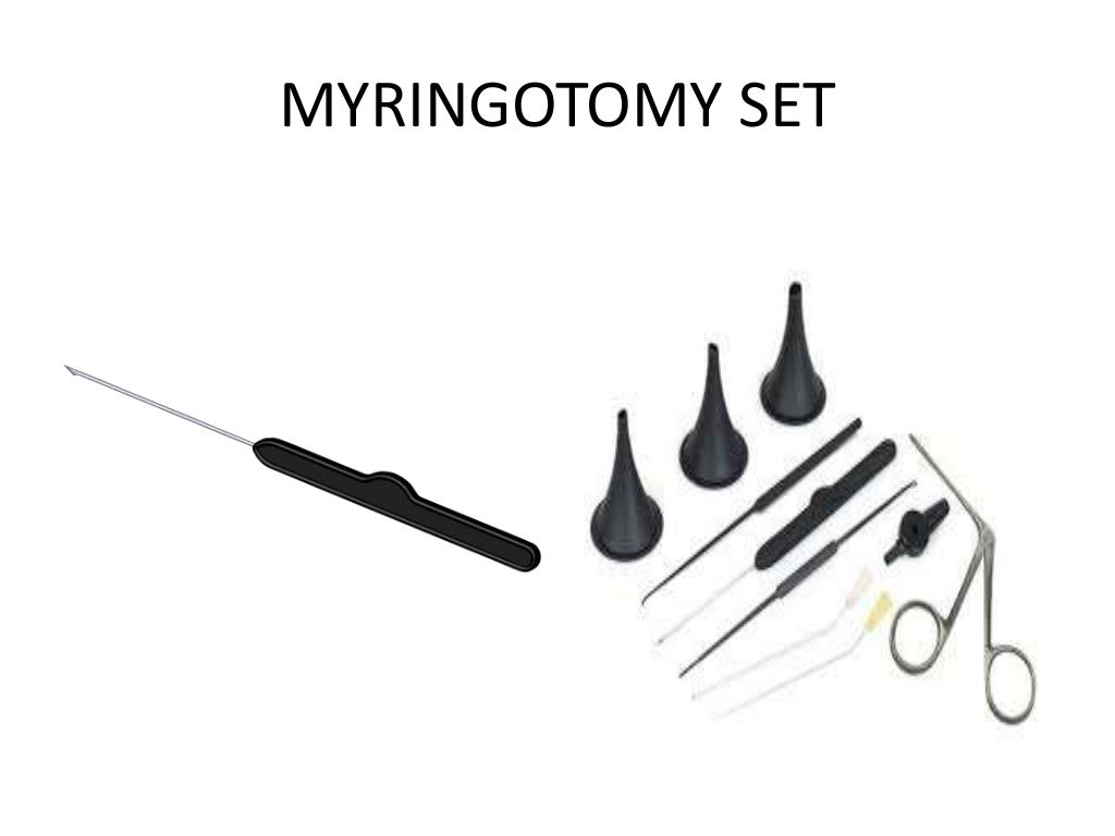 Myringotomy and grommet insertion