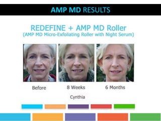 AMP MD RESULTS
 
