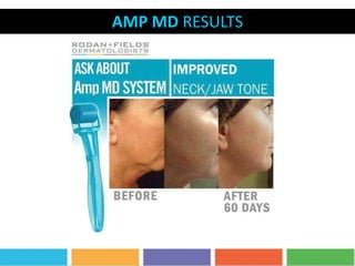 AMP MD RESULTS
 