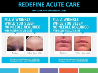 REDEFINE ACUTE CARE
SKIN CARE FOR EXPRESSION LINES
 