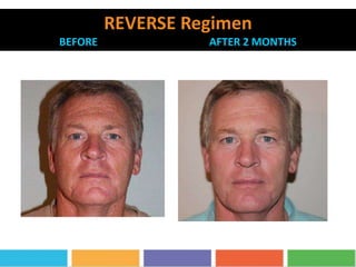 REVERSE Regimen
BEFORE AFTER 2 MONTHS
 