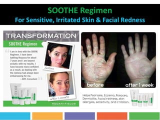 SOOTHE Regimen
For Sensitive, Irritated Skin & Facial Redness
 