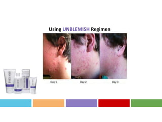 Using UNBLEMISH Regimen
 