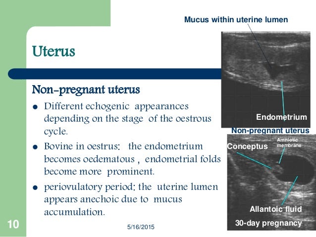 A Review of PRACTICAL APPLICATIONS OF TRANSRECTAL ULTRASONOGRAPHY FOR…
