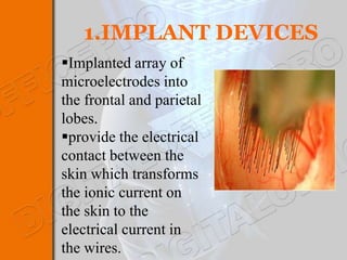1.IMPLANT DEVICES
Implanted array of
microelectrodes into
the frontal and parietal
lobes.
provide the electrical
contact between the
skin which transforms
the ionic current on
the skin to the
electrical current in
the wires.
 