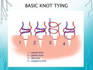BASIC KNOT TYING 
1 2 3 4 
1 – square knot 
2 – granny knot 
3 - slip knot 
4 – surgeon’s knot 
 