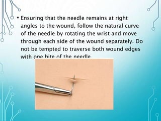 • Ensuring that the needle remains at right 
angles to the wound, follow the natural curve 
of the needle by rotating the wrist and move 
through each side of the wound separately. Do 
not be tempted to traverse both wound edges 
with one bite of the needle 
 