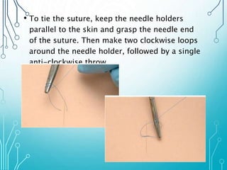 • To tie the suture, keep the needle holders 
parallel to the skin and grasp the needle end 
of the suture. Then make two clockwise loops 
around the needle holder, followed by a single 
anti-clockwise throw. 
 