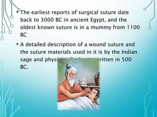 • The earliest reports of surgical suture date 
back to 3000 BC in ancient Egypt, and the 
oldest known suture is in a mummy from 1100 
BC 
• A detailed description of a wound suture and 
the suture materials used in it is by the Indian 
sage and physician Sushruta, written in 500 
BC. 
 