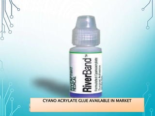 CYANO ACRYLATE GLUE AVAILABLE IN MARKET 
*Image via Bing 
 