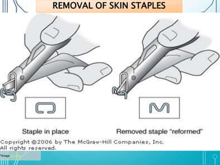 *Image via Bing 
REMOVAL OF SKIN STAPLES 
 