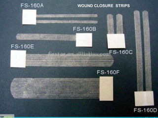 Image via Bing 
WOUND CLOSURE STRIPS 
 