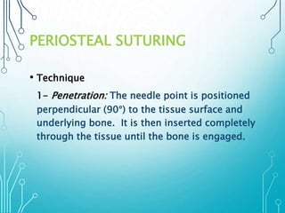 PERIOSTEAL SUTURING 
• Technique 
1- Penetration: The needle point is positioned 
perpendicular (90°) to the tissue surface and 
underlying bone. It is then inserted completely 
through the tissue until the bone is engaged. 
 