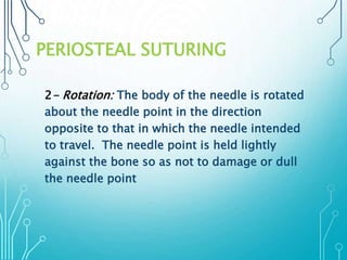 PERIOSTEAL SUTURING 
2- Rotation: The body of the needle is rotated 
about the needle point in the direction 
opposite to that in which the needle intended 
to travel. The needle point is held lightly 
against the bone so as not to damage or dull 
the needle point 
 