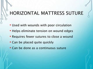 HORIZONTAL MATTRESS SUTURE 
• Used with wounds with poor circulation 
• Helps eliminate tension on wound edges 
• Requires fewer sutures to close a wound 
• Can be placed quite quickly 
• Can be done as a continuous suture 
 