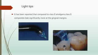Light tips
 It has been reported that compared to class II amalgams,class II
composites leak significantly more at the gingival margins.
 