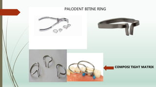 PALODENT BITINE RING
COMPOSI TIGHT MATRIX
 