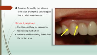  Curvature formed by two adjacent
teeth in an arch form a spillway space
that is called an embrasure
Serves 2 purposes
• Provides a spillway for passage for
food during mastication
• Prevents food from being forced into
the contact area
 