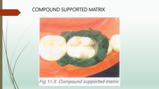 contact and contours | PPTX