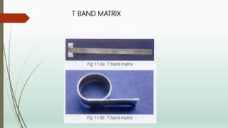 T BAND MATRIX
 