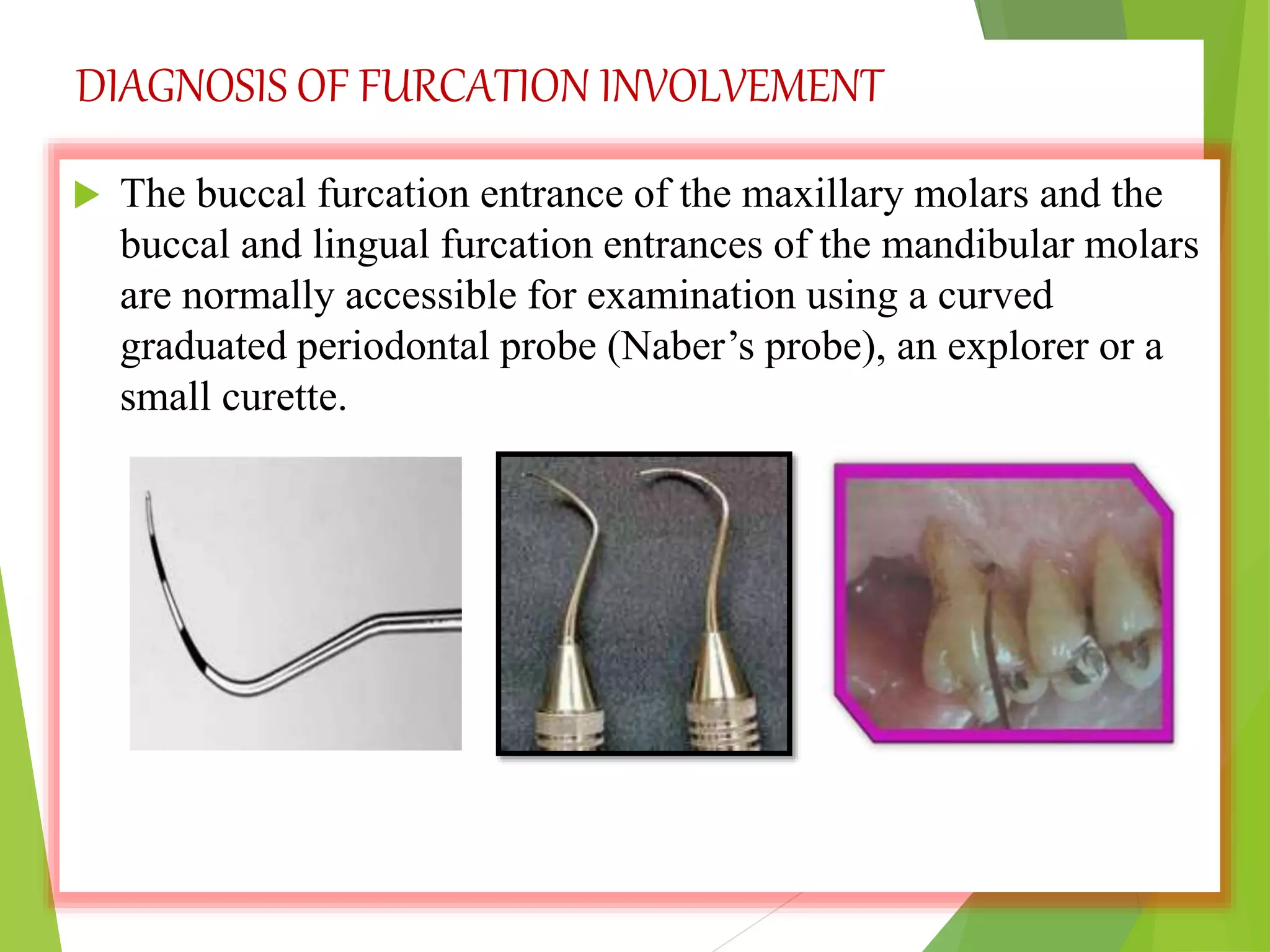 DIAGNOSIS OF FURCATION INVOLVEMENT
 The buccal furcation entrance of the maxillary molars and the
buccal and lingual furcation entrances of the mandibular molars
are normally accessible for examination using a curved
graduated periodontal probe (Naber’s probe), an explorer or a
small curette.
 
