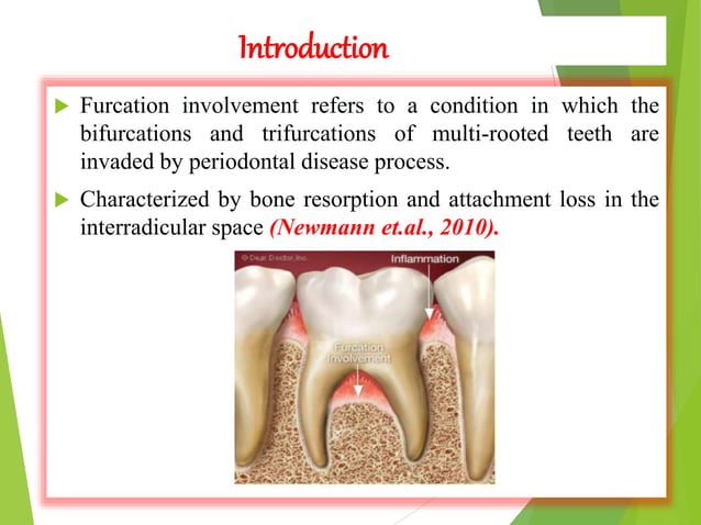 Furcation | PPTX | Dental Health | Diseases and Conditions