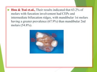  Hou & Tsai et.al., Their results indicated that 63.2% of
molars with furcation involvement had CEPs and
intermediate bifurcation ridges, with mandibular 1st molars
having a greater prevalence (67.9%) than mandibular 2nd
molars (54.8%).
 