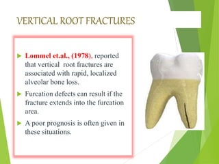 VERTICAL ROOT FRACTURES
 Lommel et.al., (1978), reported
that vertical root fractures are
associated with rapid, localized
alveolar bone loss.
 Furcation defects can result if the
fracture extends into the furcation
area.
 A poor prognosis is often given in
these situations.
 