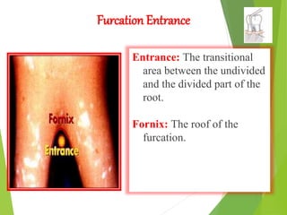 Furcation Entrance
Entrance: The transitional
area between the undivided
and the divided part of the
root.
Fornix: The roof of the
furcation.
 