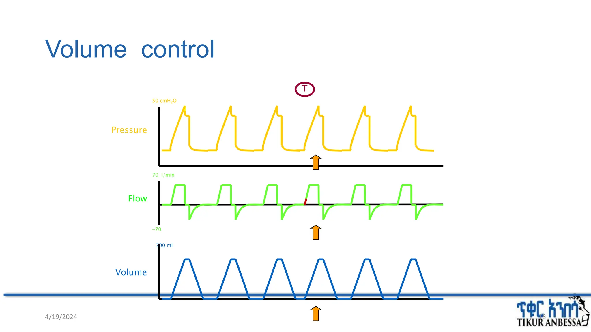 700 ml
-70
70 l/min
50 cmH2O
Volume control
Pressure
Flow
Volume
T
4/19/2024 18
 