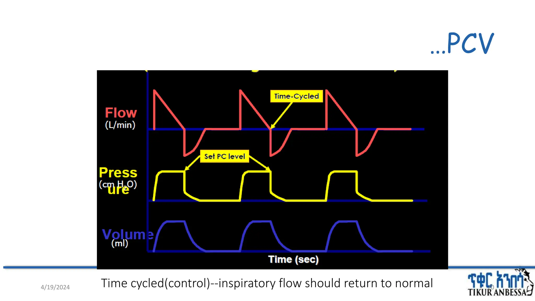 …PCV
20
Time cycled(control)--inspiratory flow should return to normal
4/19/2024
 