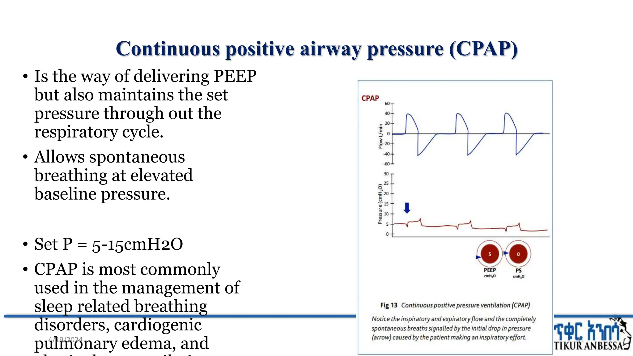 Continuous positive airway pressure (CPAP)
• Is the way of delivering PEEP
but also maintains the set
pressure through out the
respiratory cycle.
• Allows spontaneous
breathing at elevated
baseline pressure.
• Set P = 5-15cmH2O
• CPAP is most commonly
used in the management of
sleep related breathing
disorders, cardiogenic
pulmonary edema, and 31
4/19/2024
 